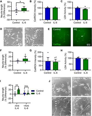 Maternal pre-eclampsia serum increases neurite growth and mitochondrial function through a potential IL-6-dependent mechanism in differentiated SH-SY5Y cells